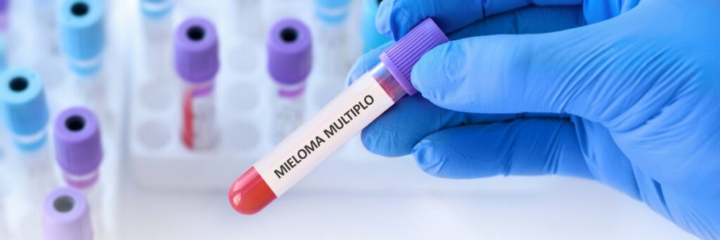 mieloma multiplo 1