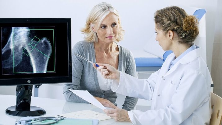 Menopausa e osteoporosi