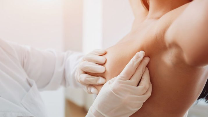 prevenzione cancro al seno clinica san giuseppe asti